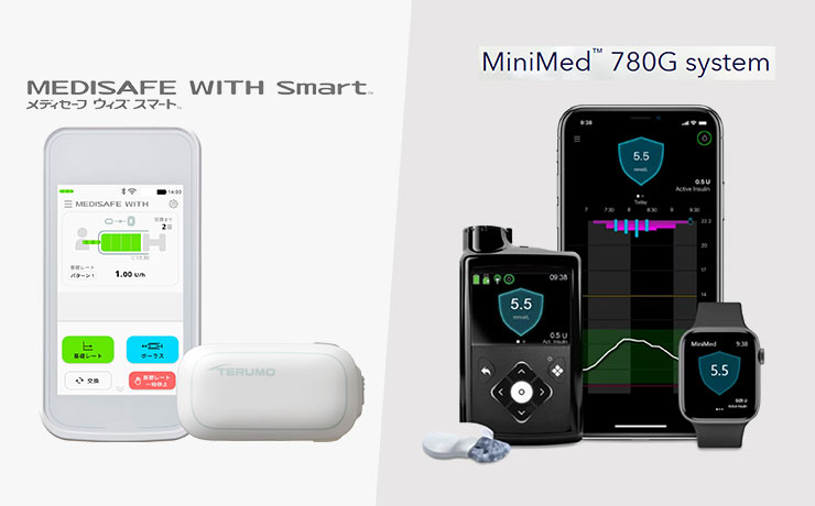 患者様の生活リズムに合わせたインスリンポンプを使用
